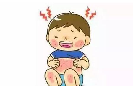 如何区分幼儿急疹与湿疹？5个方面教你判断