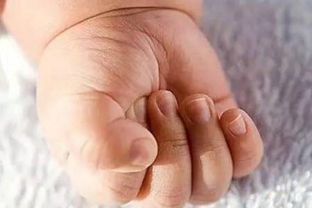 给宝宝剪指甲导致甲沟炎，正确的方法在这里！