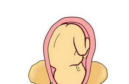 想顺产不挨刀？怀孕32周前先把这个问题搞定了再说！