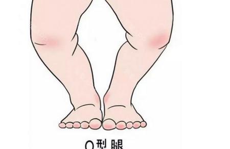 宝宝太早站会O型腿？爸妈别穷紧张吓自己
