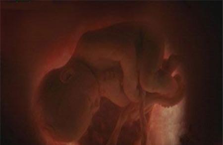 怀孕三个月胎儿图 每周发育过程详解