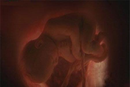 怀孕三个月胎儿图 每周发育过程详解