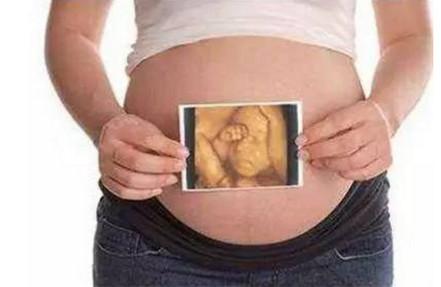 都说孕妇一定要去做彩超，然而不懂这5点就等于白做了