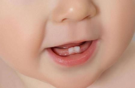 孩子牙齿磕坏了怎么办，实用经验分享