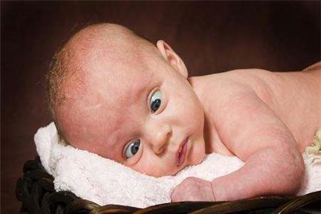 佝偻病的早期症状图片 教你一早发现端倪