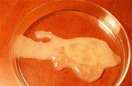 精子不液化怎么办 6个小方法快速调理精子不液化