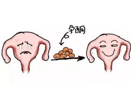 流产后半年再次有了宝宝，孕酮低一定要保胎