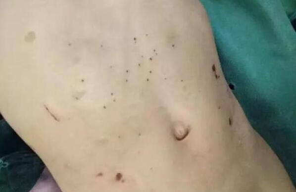 3岁女童遭后妈虐 蛇蝎心肠竟然虐待女童致死