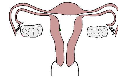 什么情况下需要做输卵管检查？哪些备孕人群？