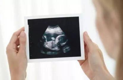 孕妈什么时候做四维彩超最好？四维彩超和其他超声检查的区别