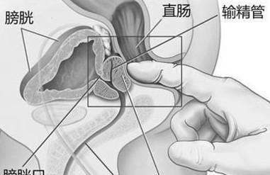 健美操的注意事项