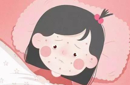 儿童常见的出疹性疾病有哪些？如何鉴别各种皮疹？