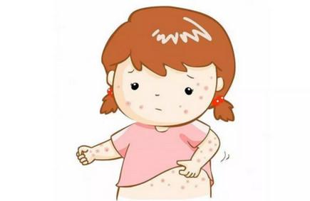 痱子湿疹有啥区别？教你如何区分痱子和湿疹