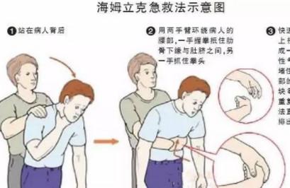 小孩子吃东西，不小心噎着了......这可咋整呀？！