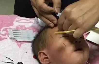 宝宝吹空调导致面瘫？！夏天如何正确给宝宝吹空调？