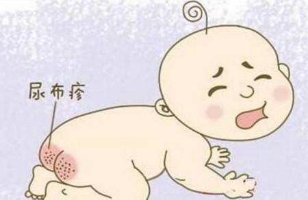 怎样预防宝宝红屁屁？引起红屁屁的原因有哪些？