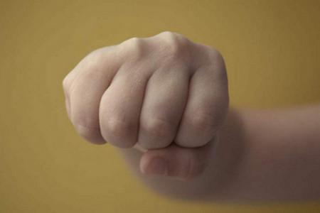 小儿紫癜能治好吗？谈谈小儿过敏性紫癜