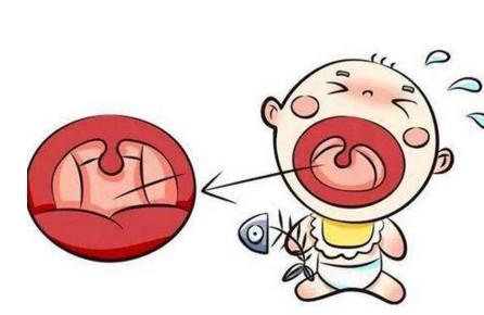 孩子被鱼刺卡喉咙了怎么办？家长不要这样做