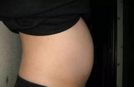 孕期检查宝宝是畸形, 孩子父母该不该生下来？！