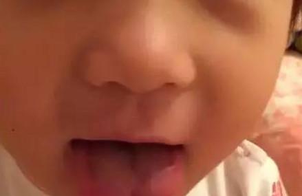 当妈后，你认真观察过娃的舌头吗？尤其是那根筋！