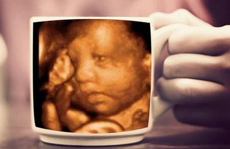 怀孕多少周做四维彩超最好？四维彩超的最佳时间