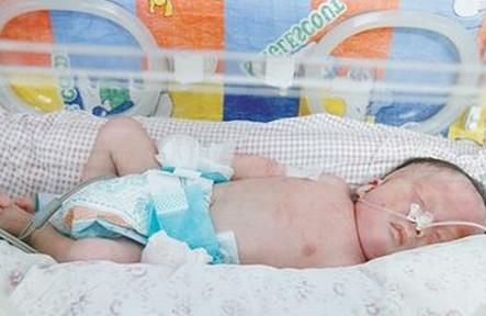 新生儿硬肿症的症状有哪些？新生儿硬肿症是由上面原因导致的