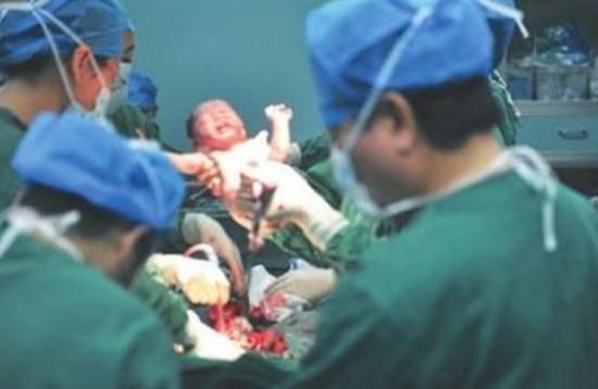 产妇剖腹产半年后又生一娃自己却丧命，剖腹产多久能要二胎？