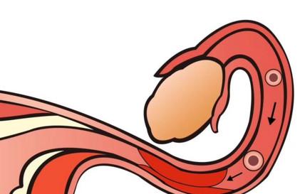 女性如何保护好输卵管?保护输卵管要注意哪些问题?