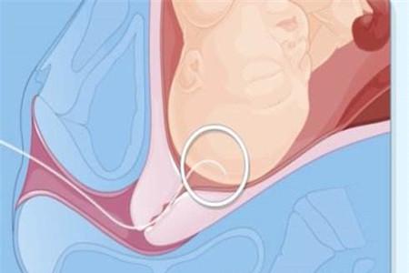 分娩时如何正确使力和呼吸 正确方法让你事半功倍