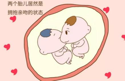有双胞胎或者是多胞胎的孕妈要注意，防止胎宝相害