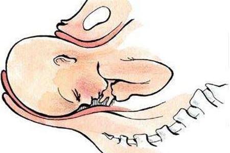 分娩时最主要的产力是什么 三大产力要区分