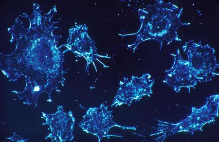 癌细胞恶性程度排行榜