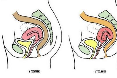 子宫前后位对怀孕有什么影响？子宫后位同房要采取什么姿势？