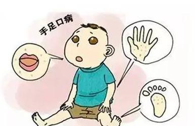 手足口病高发期来了，关于手足口病你了解多少？