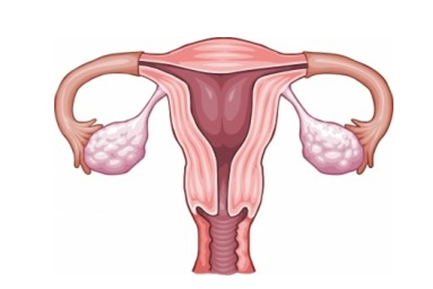 卵巢黄体破裂怎么治疗 黄体破裂一定要及时治疗