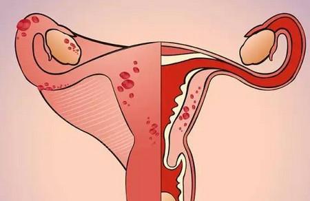 排卵期出血影響受孕嗎？會(huì)影響好孕嗎？