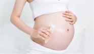 孕妇可以用清凉油止痒吗？