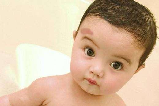 宝宝胎记的种类及图片 宝宝不同位置和颜色的胎记全分析