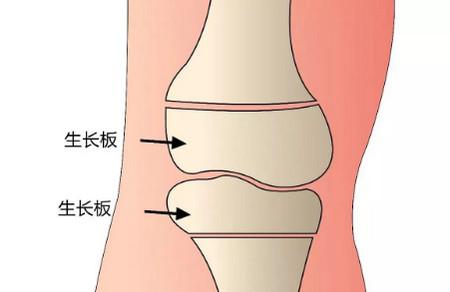 儿童腿部发育关键期是什么时候？难道不是青春期？