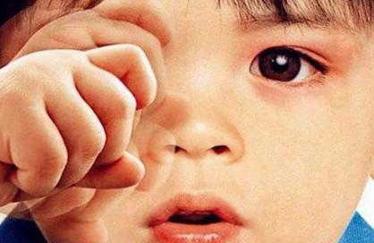 孩子频繁眨眼，家长要警惕这5大问题！