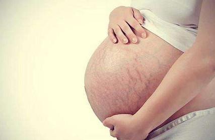 哪3种孕妈不长妊娠纹？哪3种孕妈容易增长妊娠纹？如何避免？