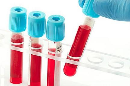 为什么第二胎容易溶血？ABO溶血没那么可怕