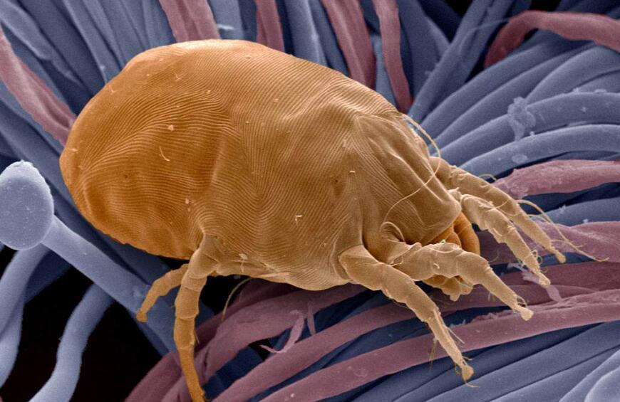 预防宝宝被螨虫咬的方法 教你如何防止螨虫叮咬