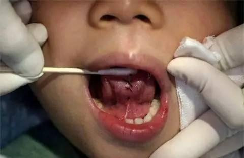 宝宝4岁说话不清楚被骂是大舌头是怎么回事？
