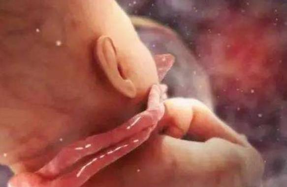 准妈妈如何应对胎儿脐带绕颈？脐带绕颈能顺产吗？