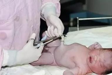 宝宝出生后多长时间剪断脐带？你知道吗？