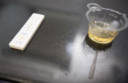 “大大皮”小便里的大学问，准妈请做好每次尿检