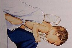 宝宝喝水老是呛到怎么办 婴儿喝水呛咳的护理措施