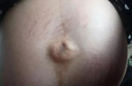 孕妇肚脐凸出来的就一定会是儿子吗？能说明我怀的就是男孩？