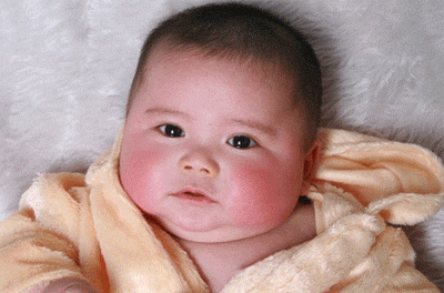乱抠宝宝乳痂易生病！如何正确护理宝宝乳痂？